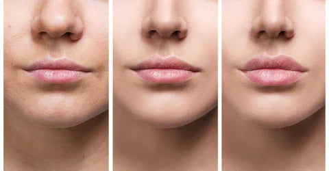 Direct Lippenvolume-Serum