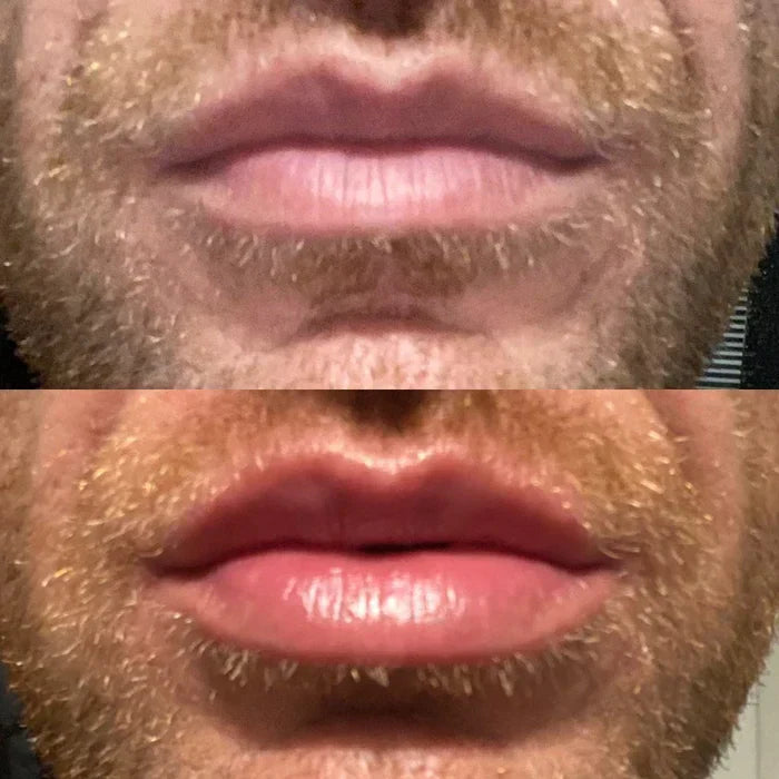 Direct Lippenvolume-Serum