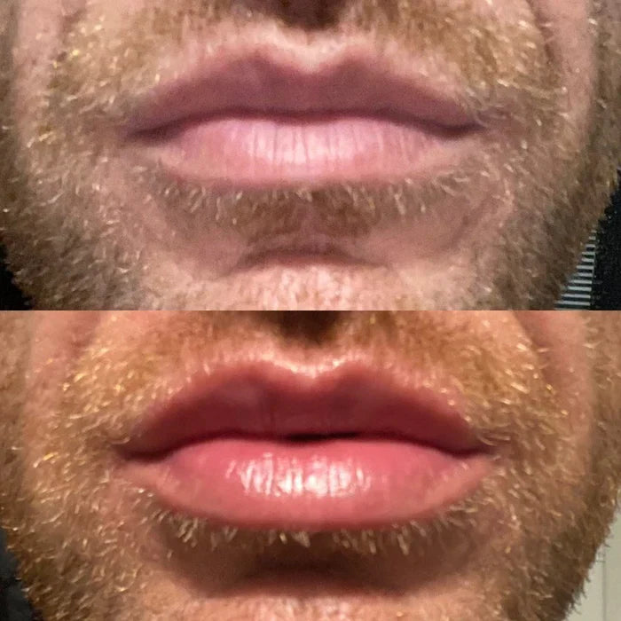 Krijg Sneller Vollere Lippen met LumaGlow Lip Plumper Serum