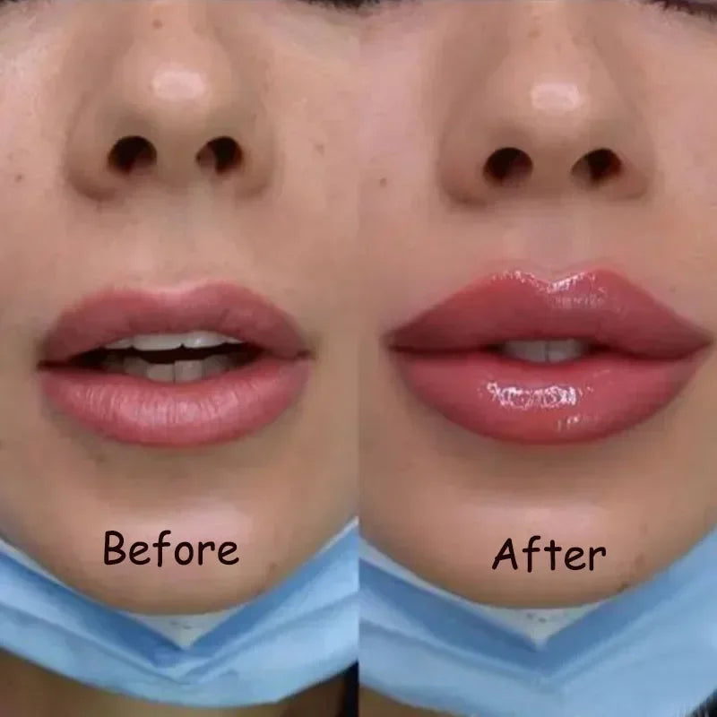 Krijg Sneller Vollere Lippen met LumaGlow Lip Plumper Serum