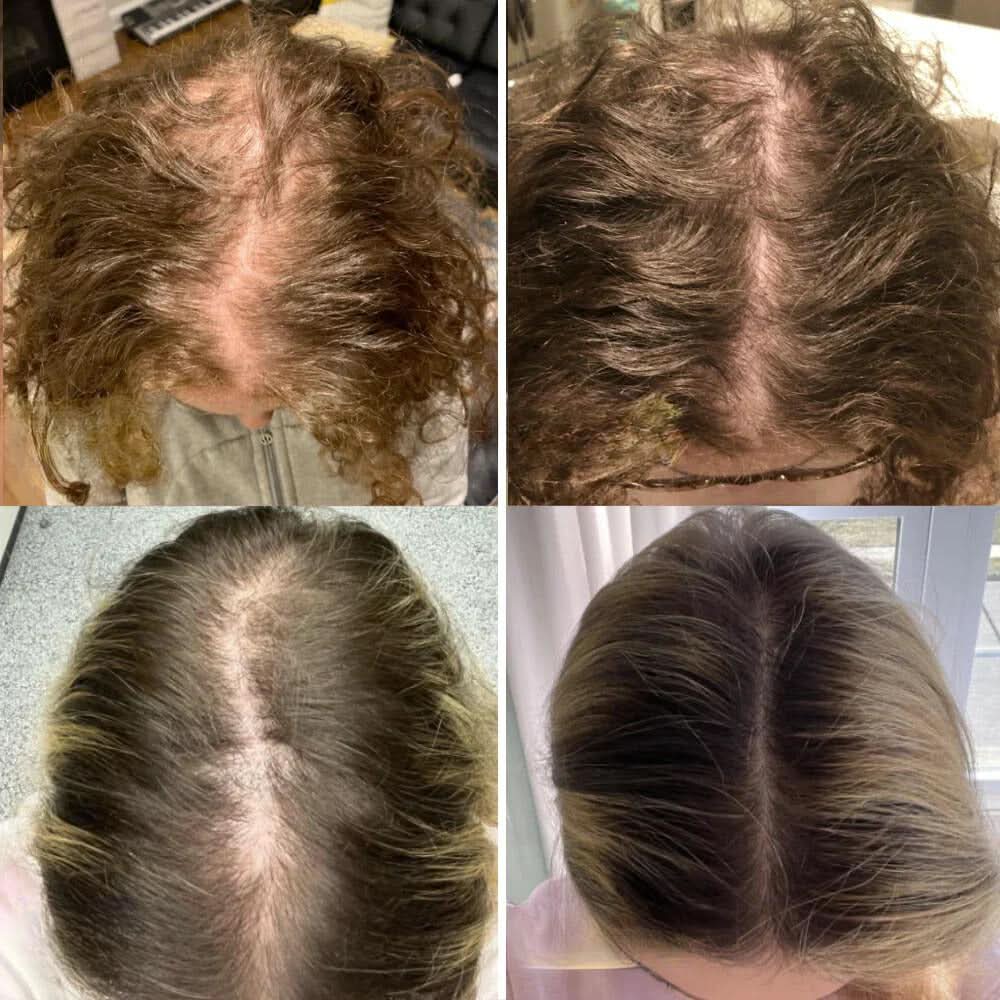 Je natuurlijke olie voor haargroei