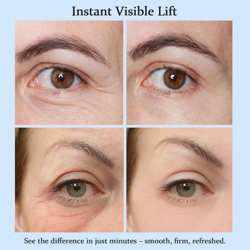 YoPoll Instant Eye Lift Cream Verstevigt & Verfrist Vermoeide Ogen