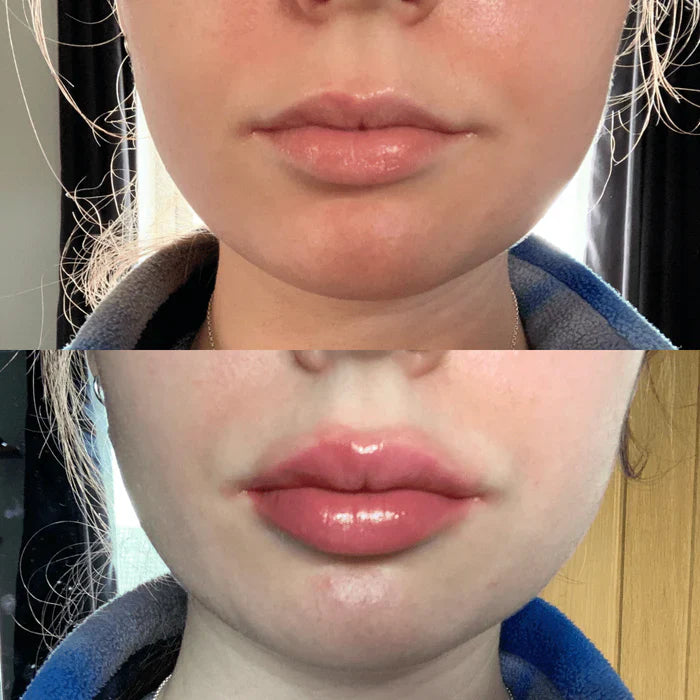 Krijg Sneller Vollere Lippen met LumaGlow Lip Plumper Serum