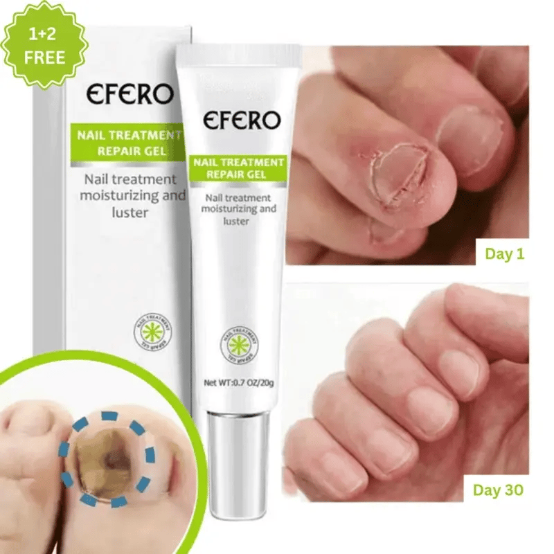 Efero® Nagelherstelgel: 1 + 2 GRATIS – Tijdelijke aanbieding