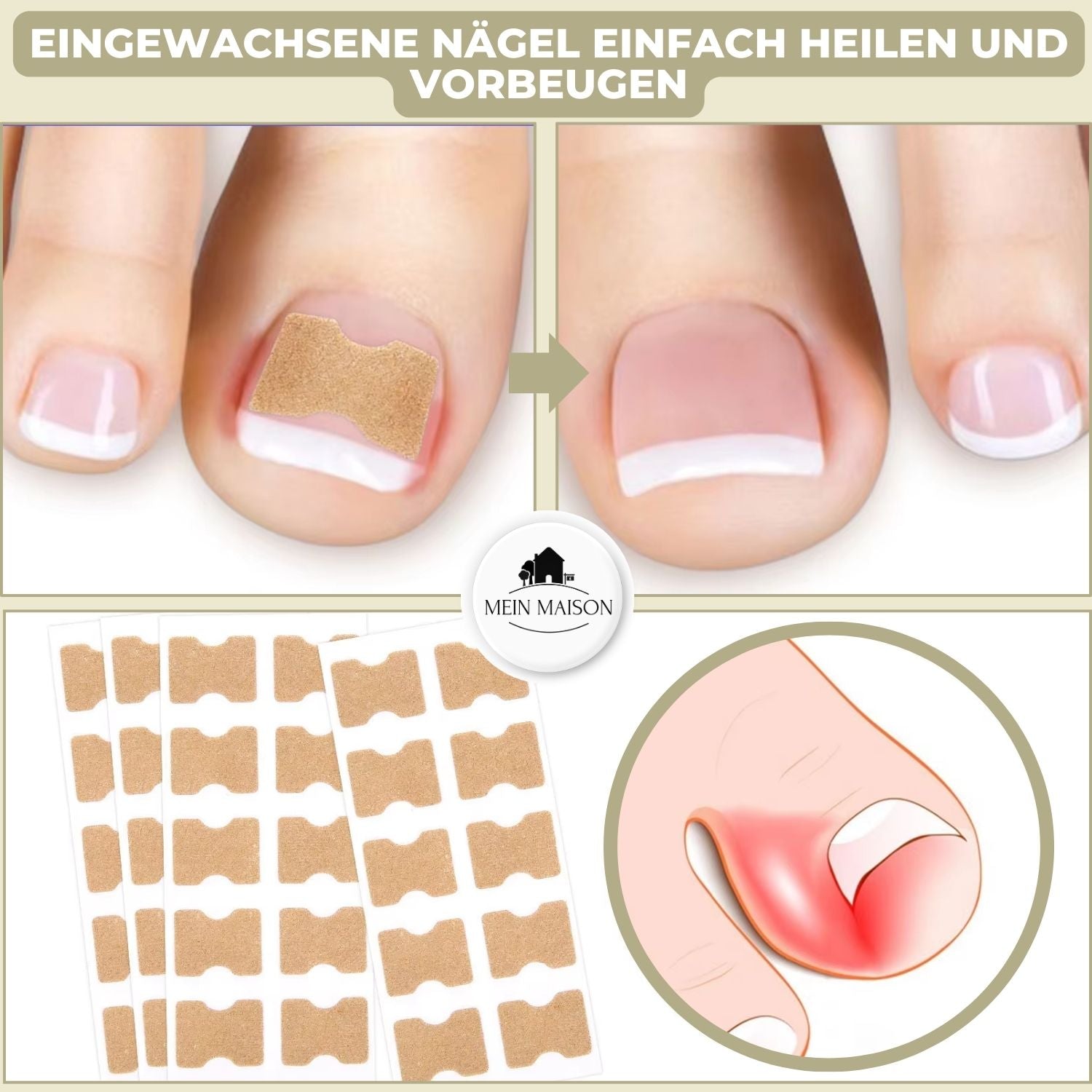 10+10 Gratis FixaNail Directe Nagelreparatie