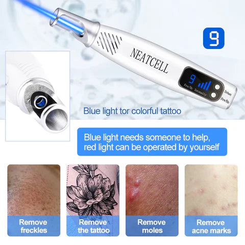 LumiDerm Thuis Laser Pen voor Tattoo Verwijdering, Moedervlekken en Vlekken