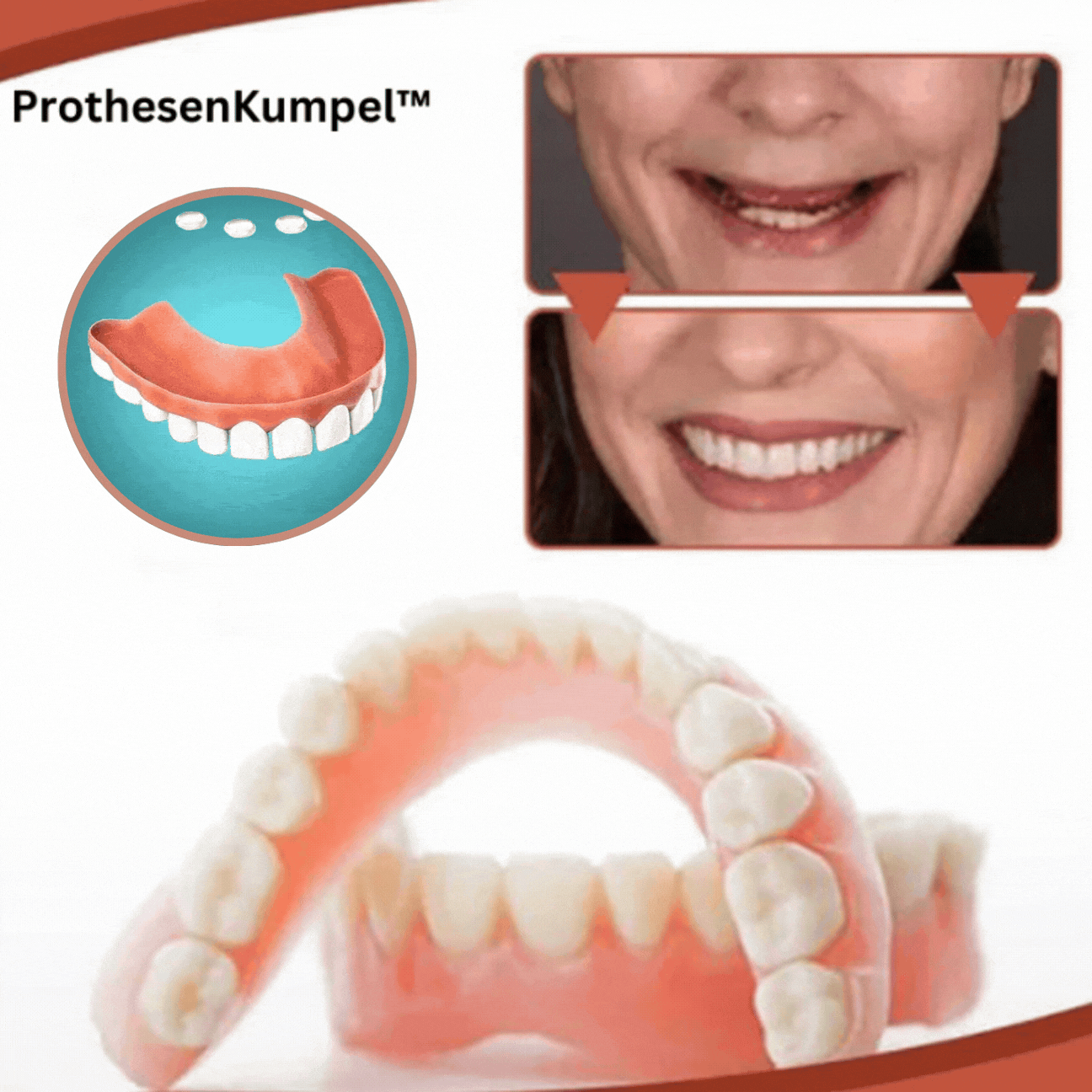 Protheses | Aanpassing van Tandprotheses | Veilige Houden & Natuurlijke Glimlach | PureSmile