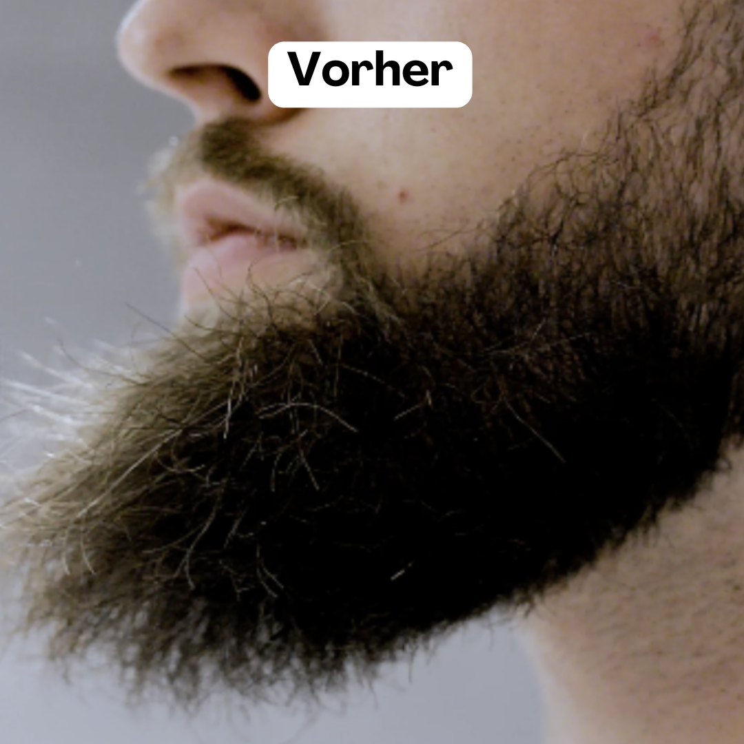 BeardMaster | Draadloze Negatieve Ion Beard Styler