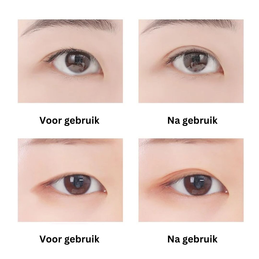EyePerfection | Dubbele Ooglid Tape tegen hangend ooglid | Unisex