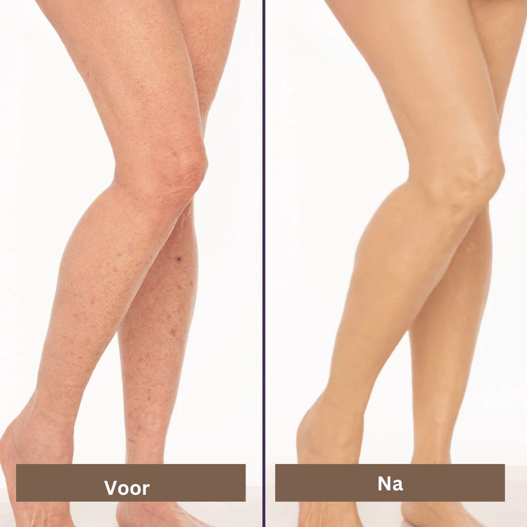 SmoothTone skincare | Voor het bedekken van littekens, aderen, acne, en zonnevlekken