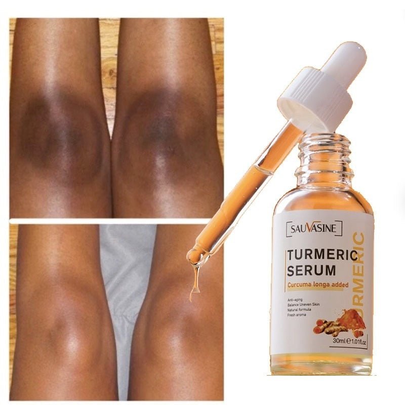 Kurkuma Donkere Vlekken Correctieserum