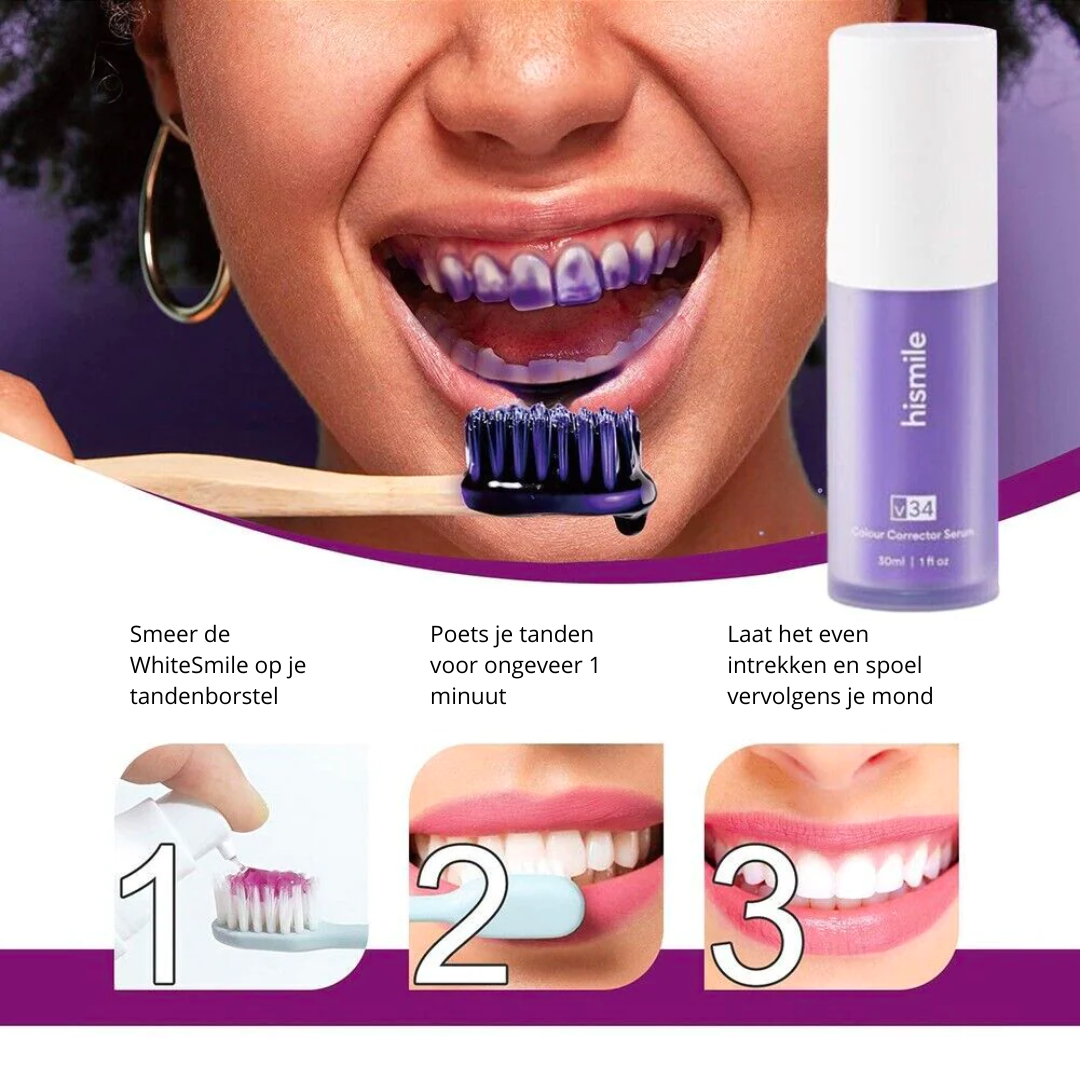 WhiteSmile | Een stralende lach binnen minuten | Combideal