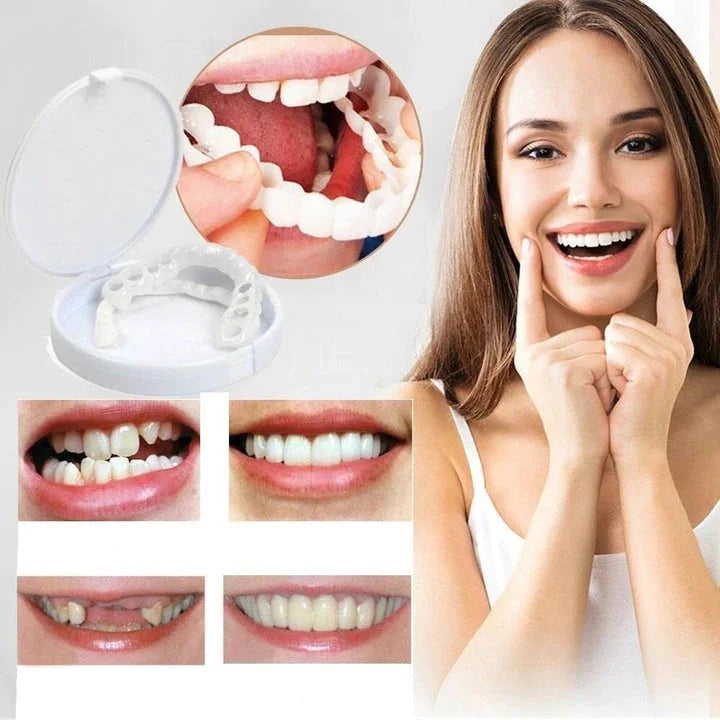 Snap-On Veneers Van NovaBright Creëer Snel, Natuurlijk Lijkende Glimlach Voor Boven- En Onderste Tanden