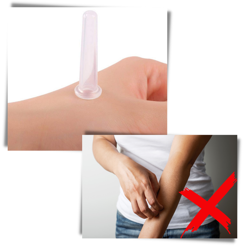 4 Siliconen Bekers voor Gezichtsmassage Cupping