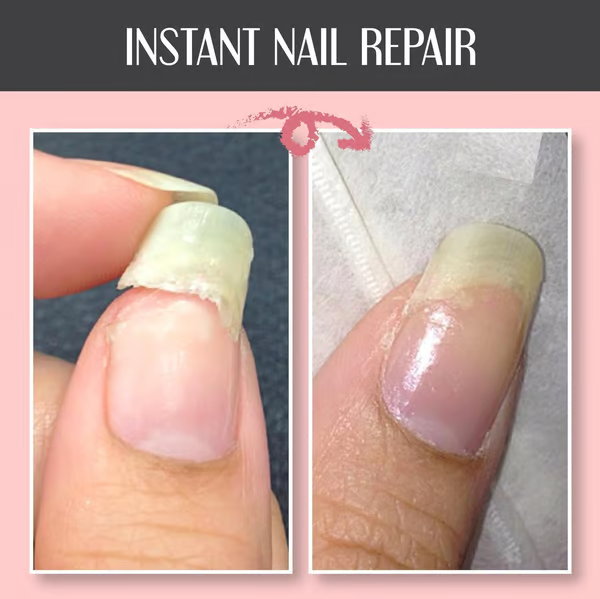 Reparerende en Beschermende Nagelgel: Versterkt en Regenerates