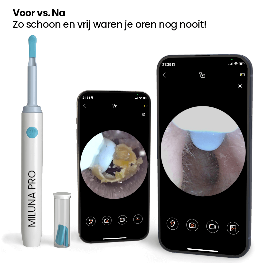 LuxeEar Pro | Slimme oorreiniger met HD-camera voor optimale hygiëne