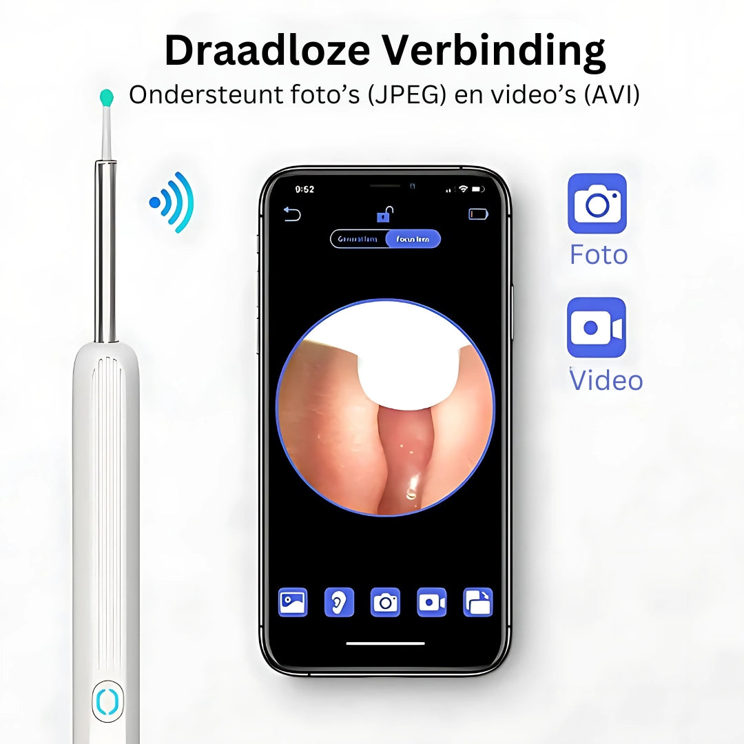 AureliaVision Luxe Oorreiniger | HD-camera voor een grondige oorreiniging