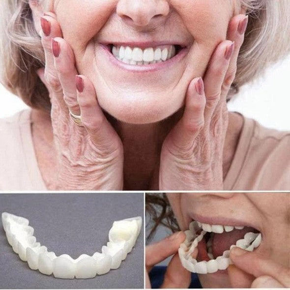 Op Smile Veneers (boven- en onderkaak inbegrepen)