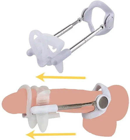 Quellix Traction Oplossing Voor Ondersteuning En Verbetering