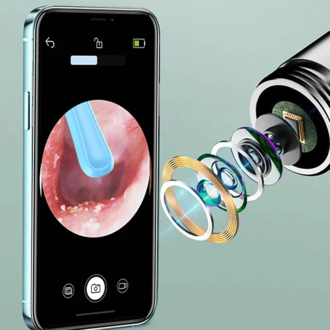 AureliaVision Luxe Oorreiniger | HD-camera voor een grondige oorreiniging