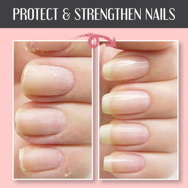 Reparerende en Beschermende Nagelgel: Versterkt en Regenerates