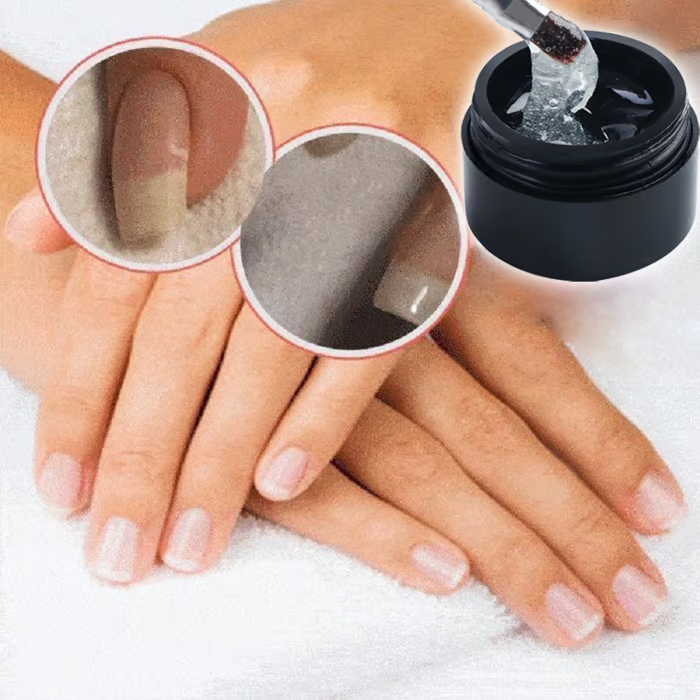 Reparerende en Beschermende Nagelgel: Versterkt en Regenerates