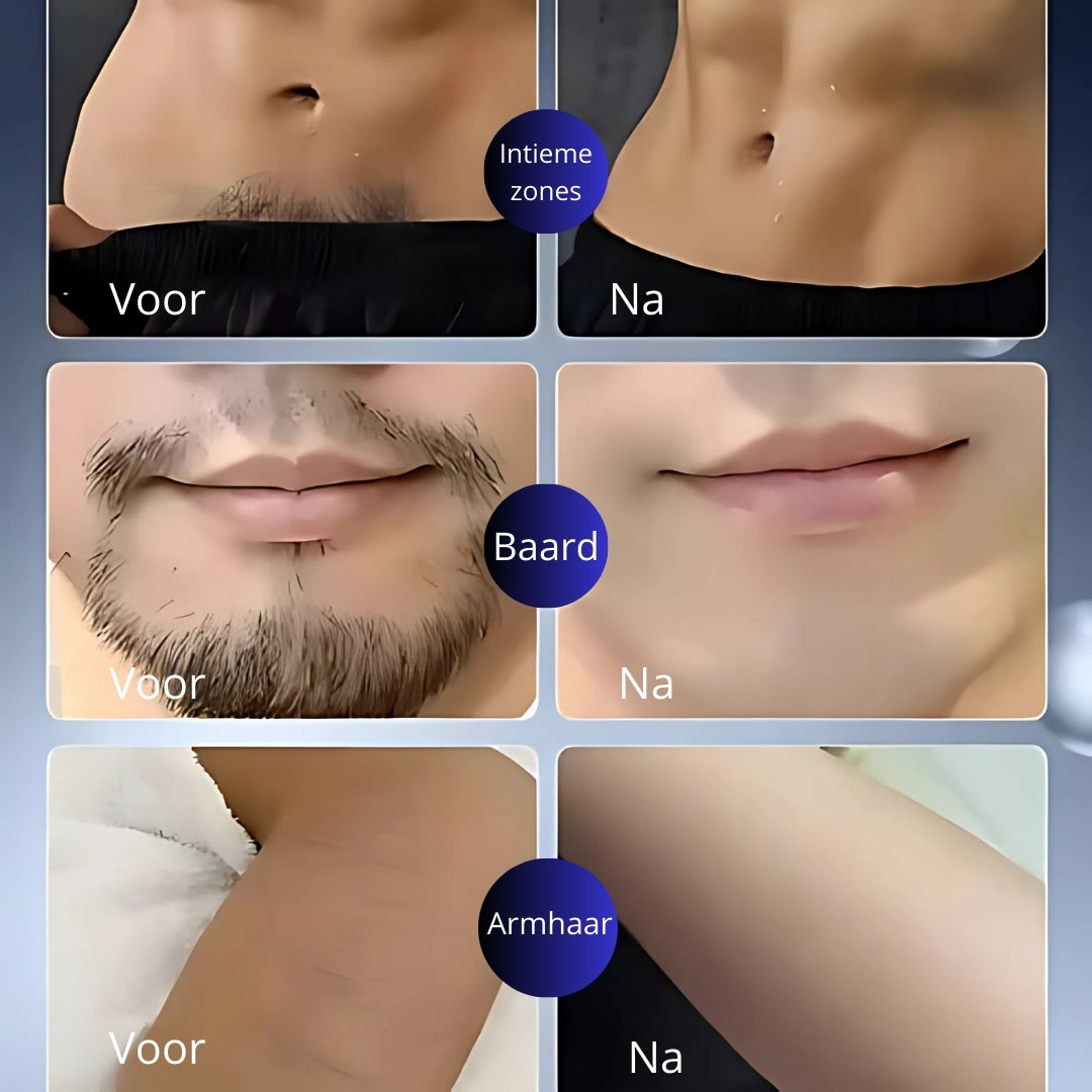 LuxuraShave Draadloos Elektrisch Scheerapparaat | Ervaar ultieme comfort en precisie bij het scheren