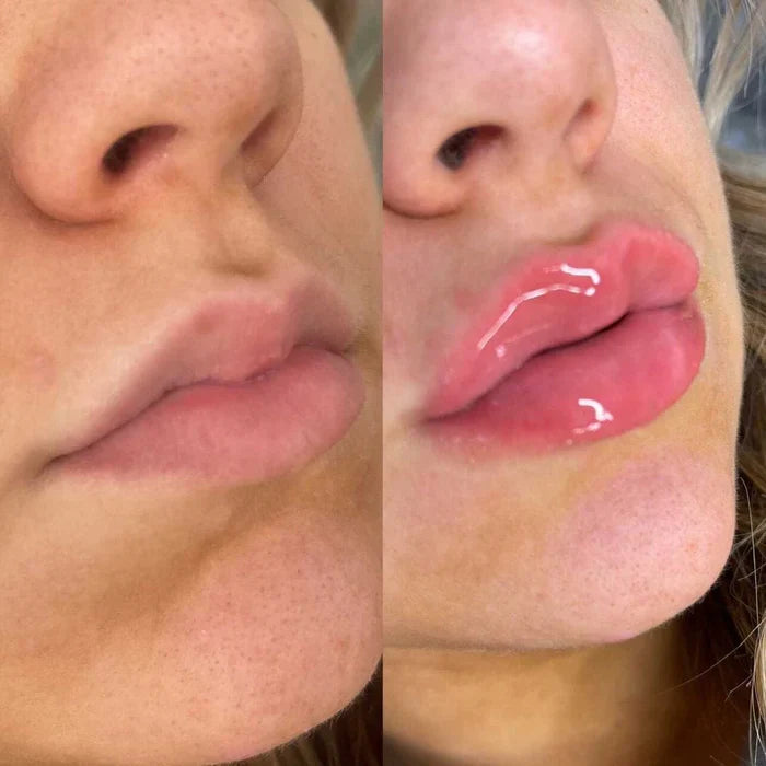 Krijg Sneller Vollere Lippen met LumaGlow Lip Plumper Serum