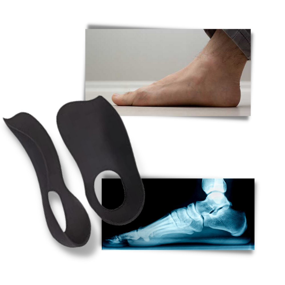 Orthopedische inlegzolen voor platte voeten