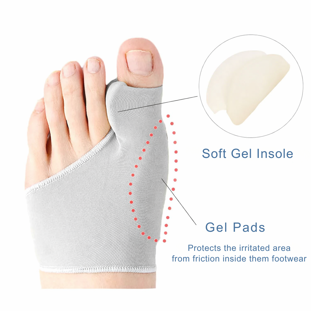 Hallux Valgus | Teencorrector | Drukverlichting bij het lopen | ToeAlign