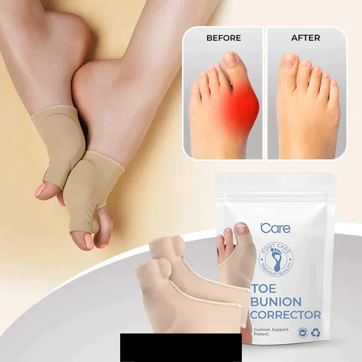 Hallux Valgus | Teencorrector | Drukverlichting bij het lopen | ToeAlign