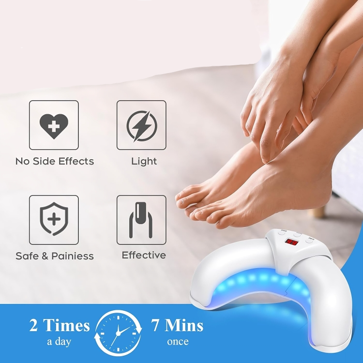 LuxeNail | Antischimmelbehandeling voor nagels – effectief – snel – natuurlijk