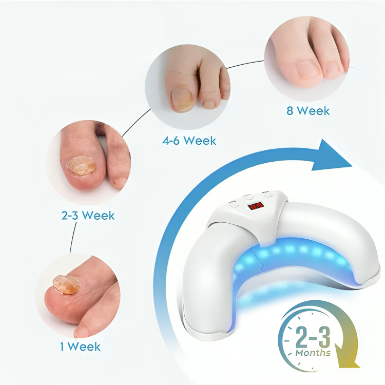 LuxeNail | Antischimmelbehandeling voor nagels – effectief – snel – natuurlijk