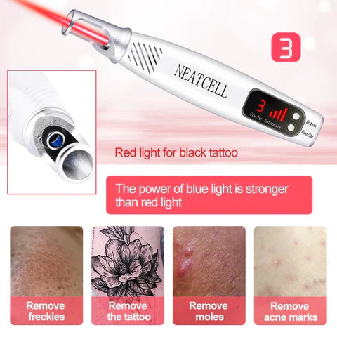 LumiDerm Thuis Laser Pen voor Tattoo Verwijdering, Moedervlekken en Vlekken