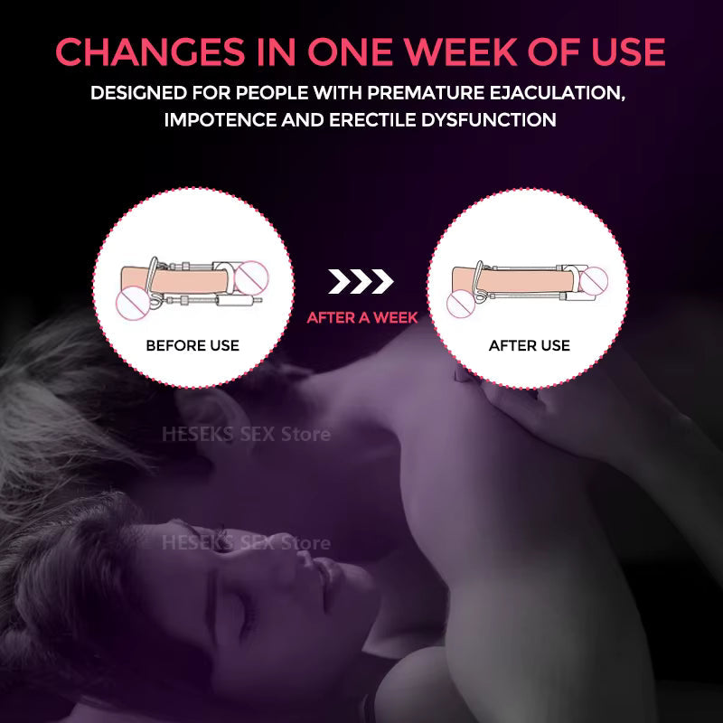 Quellix Traction Oplossing Voor Ondersteuning En Verbetering