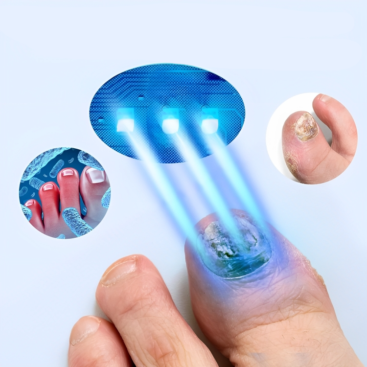 LuxeNail | Antischimmelbehandeling voor nagels – effectief – snel – natuurlijk