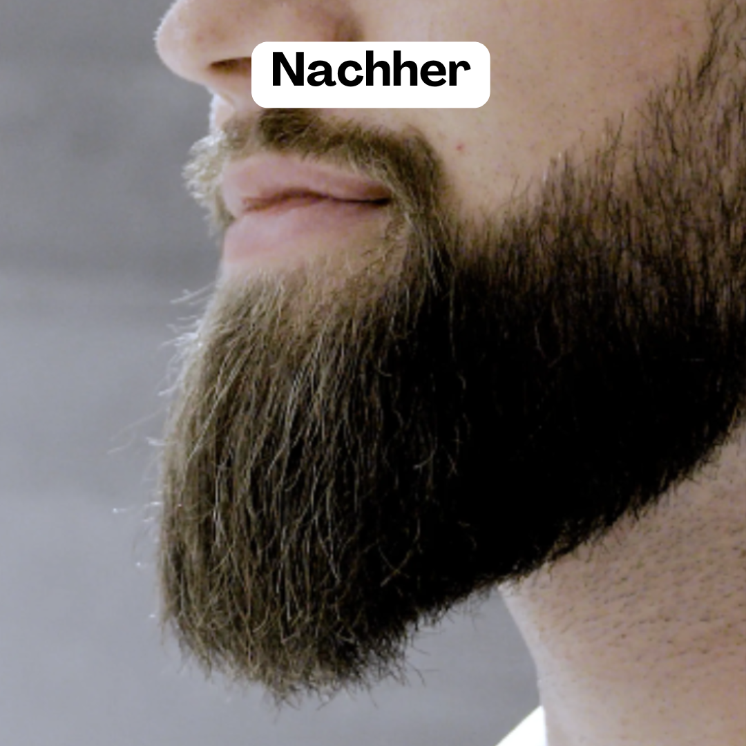 BeardMaster | Draadloze Negatieve Ion Beard Styler