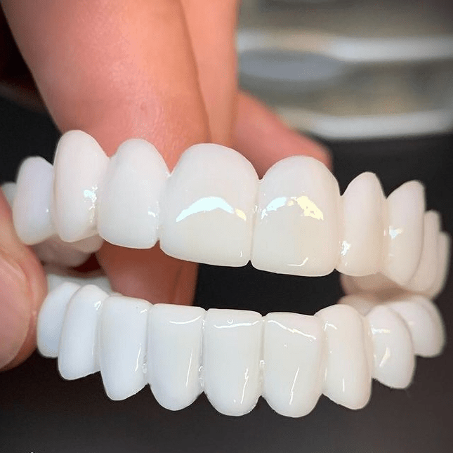 SMILEFLEX – Tandprothese met witte tandheelkundige lenzen