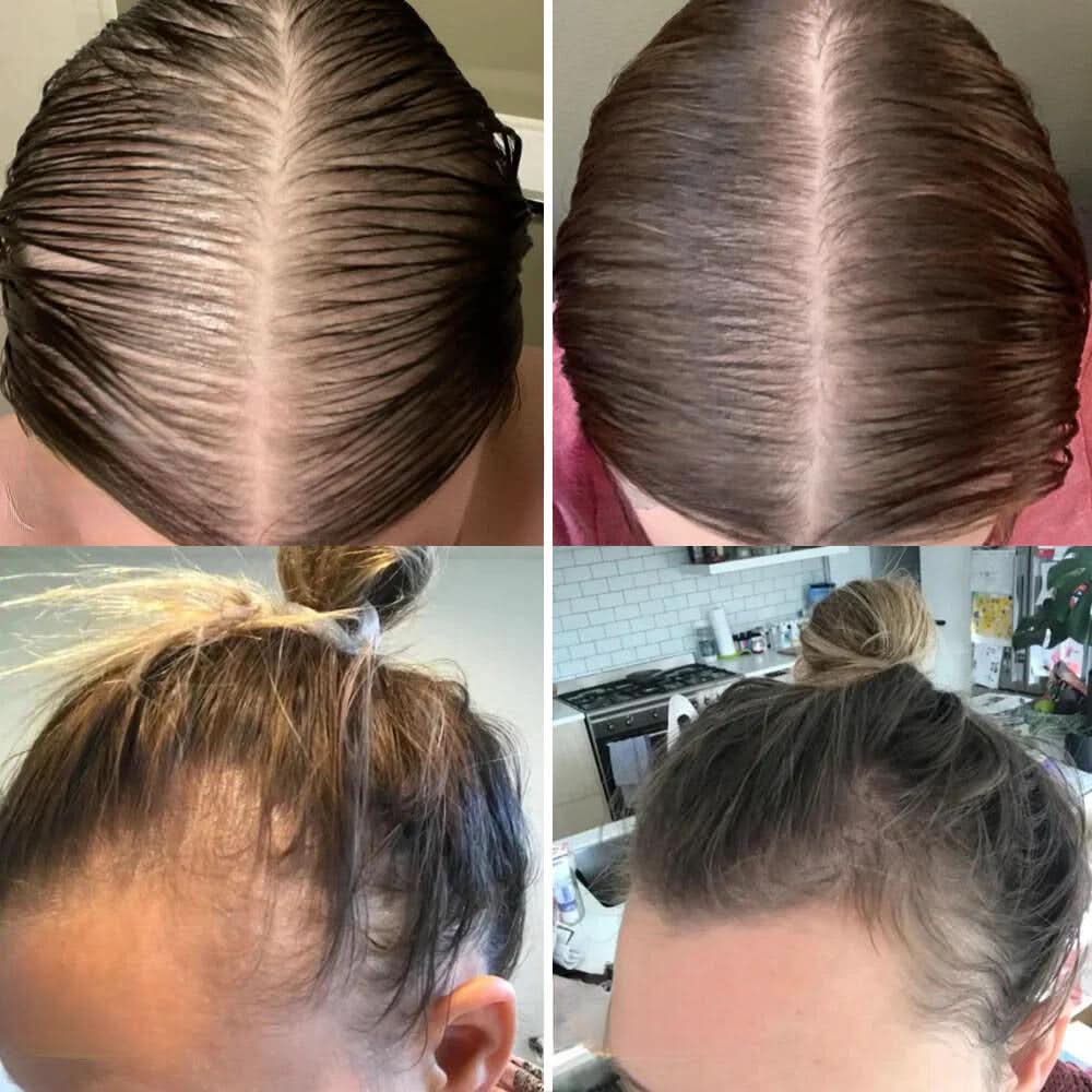 Je natuurlijke olie voor haargroei