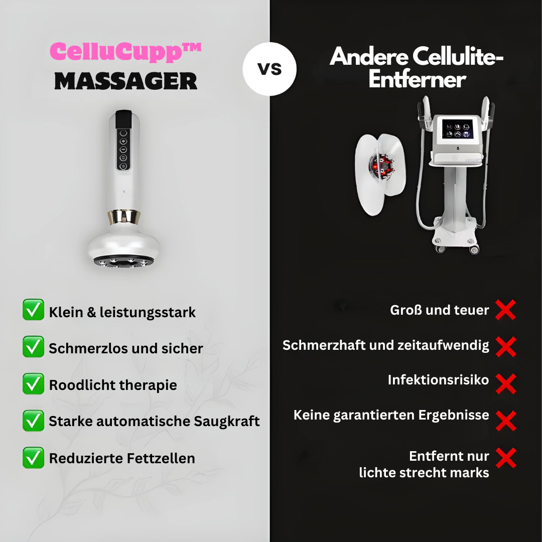 Anti-Celulite-Cupping-Apparaat – SlimCupp