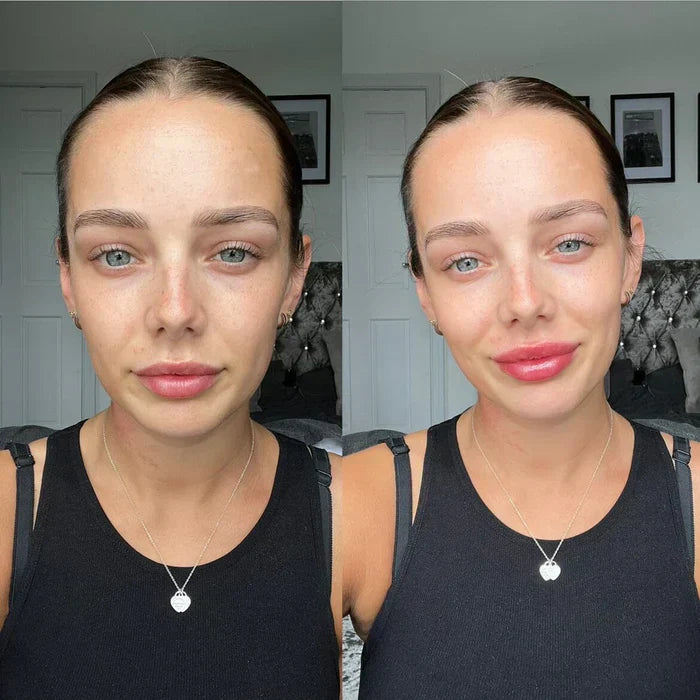 Direct Lippenvolume-Serum