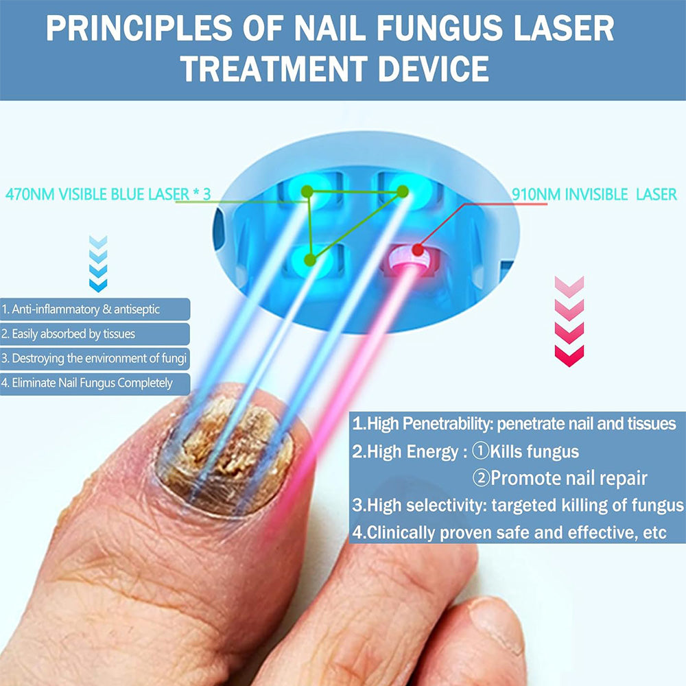 NexaLume Thuis Laser Nagelverzorgingsapparaat Makkelijk Te Gebruiken