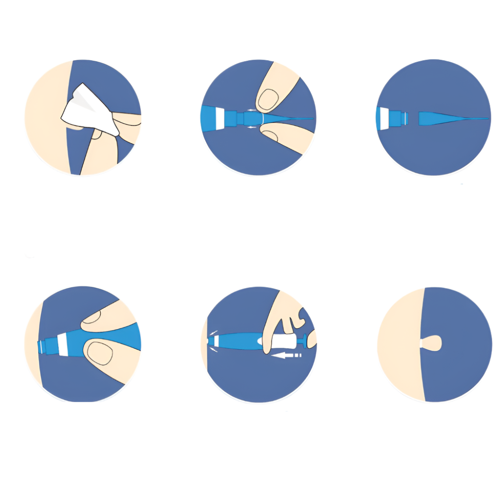 LuxuraCare Professionele Wratverwijderaar | Effectieve oplossing voor de zachte verwijdering van steelwratten